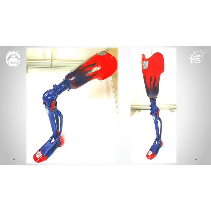 Prosthesis Leg - 2715196