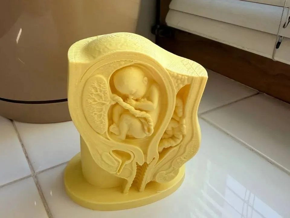 Hi3D(16) Stls